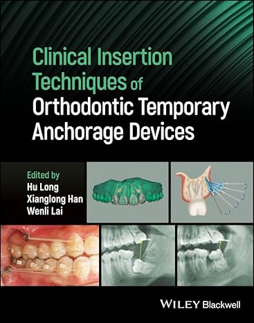 [eBook] [PDF] For Clinical Insertion Techniques of Orthodontic Temporary Anchorage Devices 1st Edition