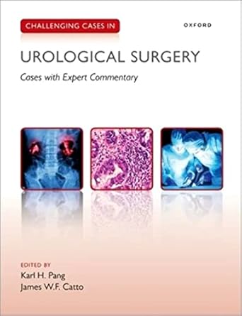 [eBook] [PDF] For Challenging Cases in Urological Surgery 1st Edition