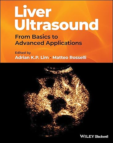 [eBook] [PDF] For Liver Ultrasound From Basics to Advanced Applications 1st Edition