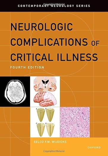 [eBook] [PDF] For Neurologic Complications of Critical Illness 4th Edition By Eelco Wijdicks